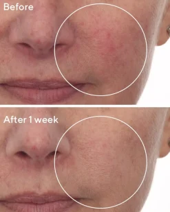 Murad Cellular Hydration Repair Serum, 30 ml- Hudpleje