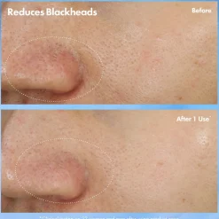 Hot Clear Improvement Blackhead Clearing Mask-To-Scrub, 75 ml Ansigtspleje