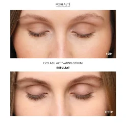 M2 Beauté Eyelash Activating Serum- Øjne