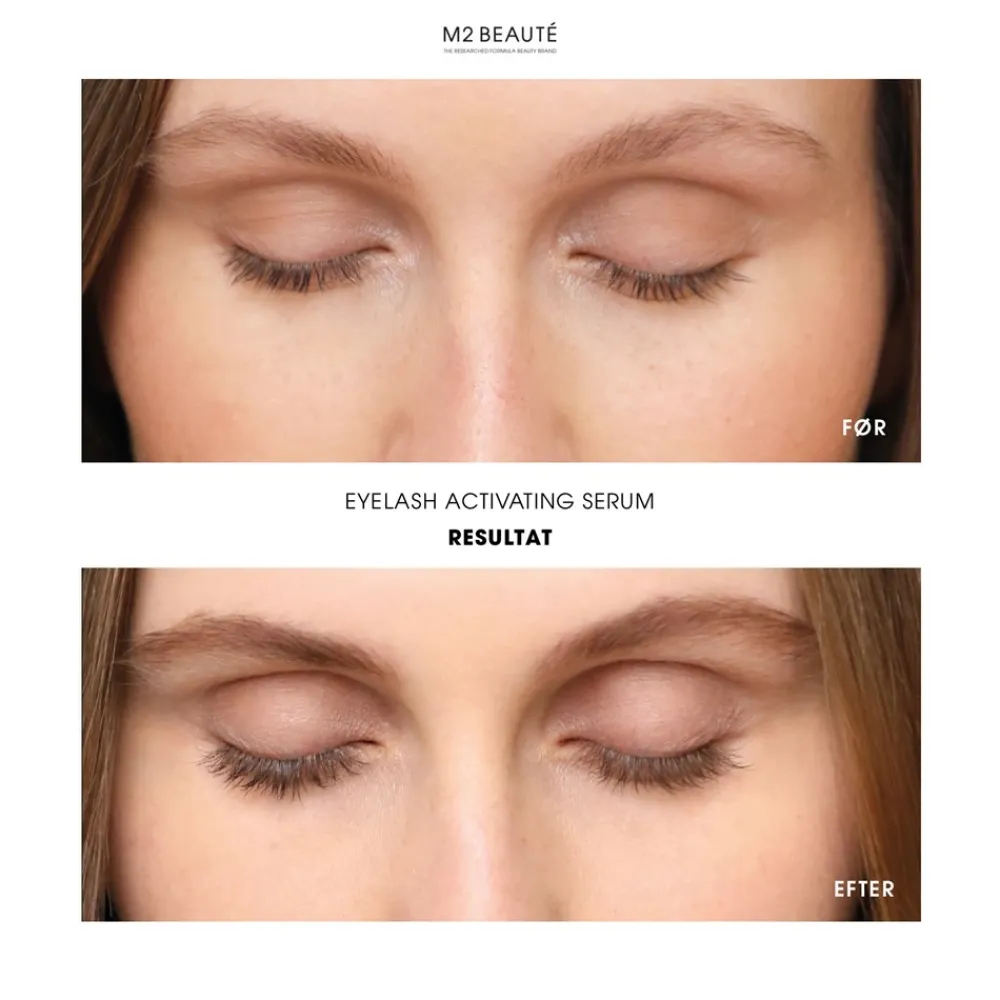 M2 Beauté Eyelash Activating Serum- Øjne
