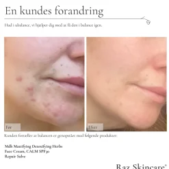 Repair Parfumefri Salve, 15 ml Kropspleje