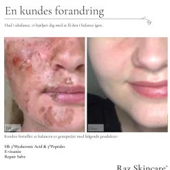Repair Parfumefri Salve, 15 ml Kropspleje