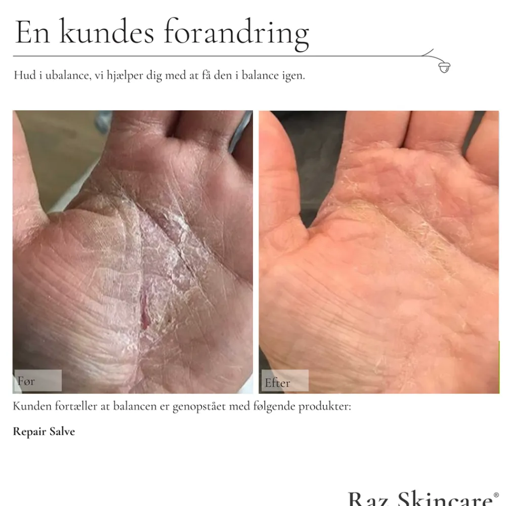 Discount Repair Parfumefri Salve, 100 ml Kropspleje