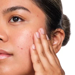 The Ordinary Salicylic Acid 2% Solution Serum, 30 ml- Ansigtspleje
