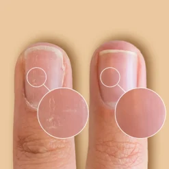 New Solaroil Nail Care Negle